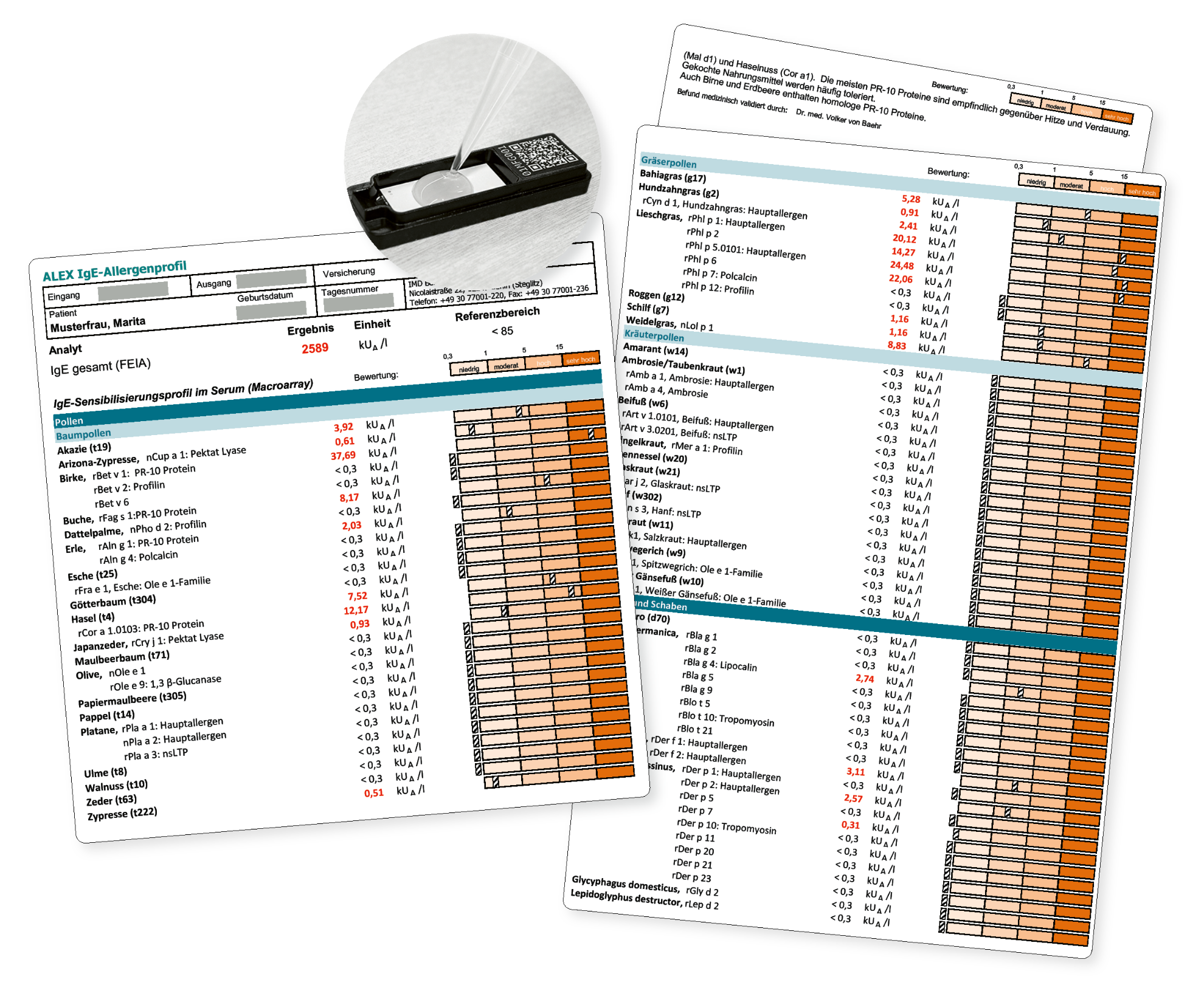 Bild von Allergiescreening - ALEX IgE Profil