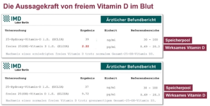 Bild von Freies Vitamin D